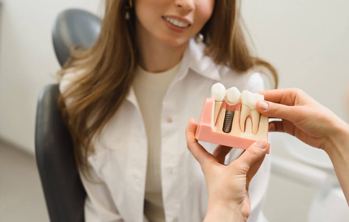 Dental implants---its Process and benefits