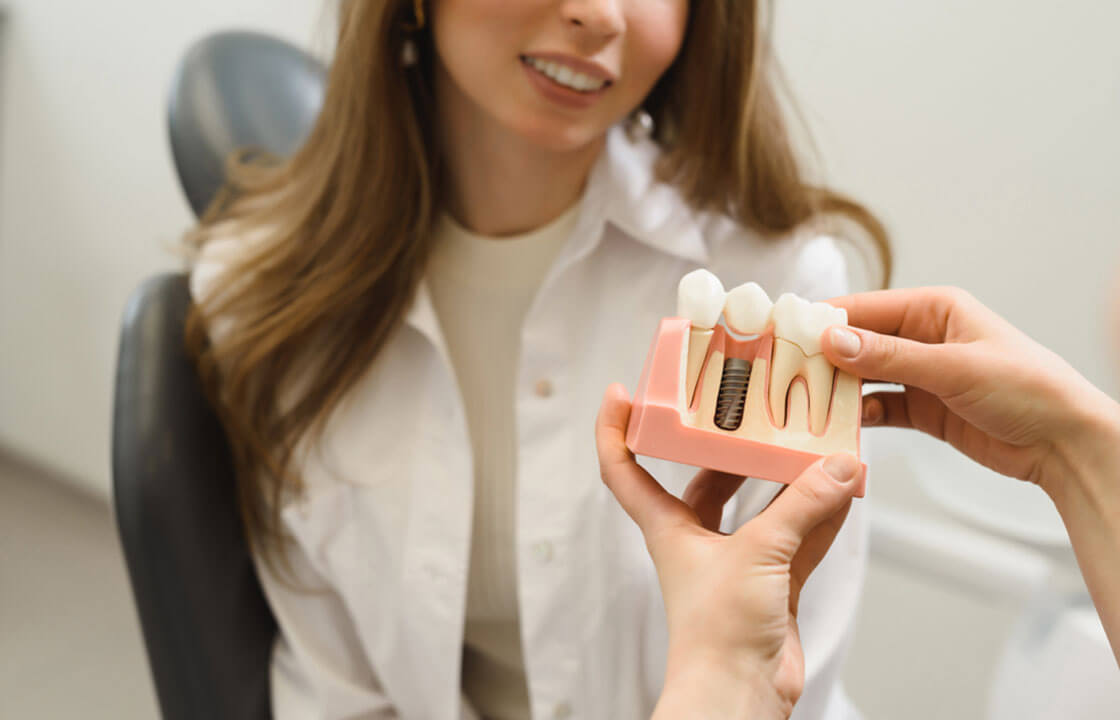Dental implants---its Process and benefits